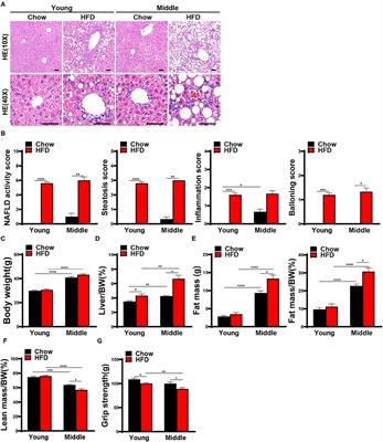 Ammonia Scavenger Restores Liver and Muscle Injury in a Mouse Model of Non-alcoholic Steatohepatitis With Sarcopenic Obesity